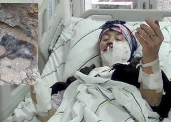 Kurt saldırısına uğrayan Uğurlu: Köpekler havlamaya başlayınca kurt beni bıraktı