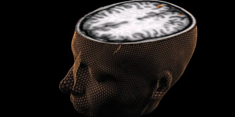 Yapay zeka beynin gördüğü bir görüntüyü yeniden üretti