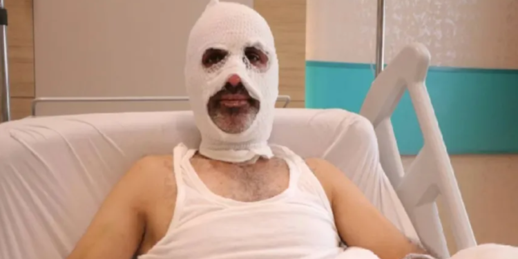 Grip yüzünden gaz kaçağını fark etmedi: 1 hafta yoğun bakımda kaldı