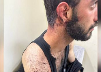 Polis şiddetinin fotoğrafı: Doktor ‘baş ağrısı’ raporu verdi