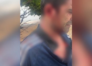 Polisin korumadığı öğretmen saldırıya uğradı