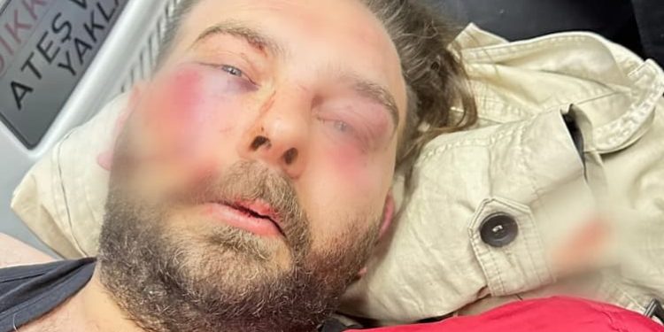 Afişleri indiren CHP’liye Gökçek’in adamları saldırmış