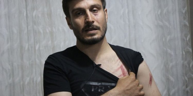 Bismil'de polis şiddetine uğrayan Eşen darp raporu aldı: Yumruk attı, yüzüme ve vücuduma vurdu