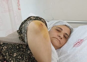 Diyarbakır'da bir kadın, DİSKİ personeli tarafından darp edildi