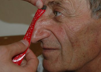 Dünyanın en uzun burunlu insanı yaşamını yitirdi!