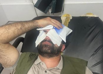 HDP’li Orak’a polis şiddeti: Ameliyatlı gözüne gaz sıkıldı