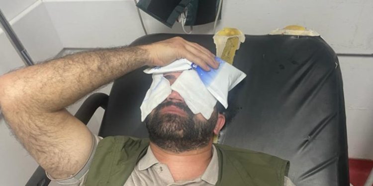 HDP’li Orak’a polis şiddeti: Ameliyatlı gözüne gaz sıkıldı