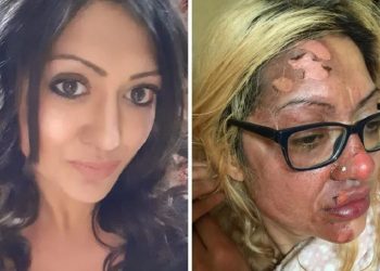 Mikrodalgada yumurta pişirmek istedi, sonu kötü bitti