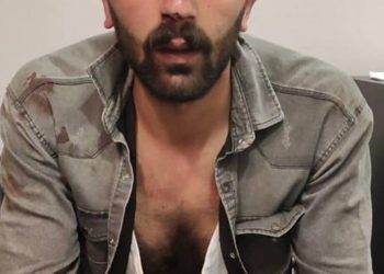Müzisyen Aymaz’ın katledilmesine tepki gösteren gençlere polis işkencesi