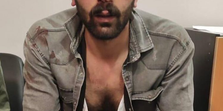 Müzisyen Aymaz’ın katledilmesine tepki gösteren gençlere polis işkencesi