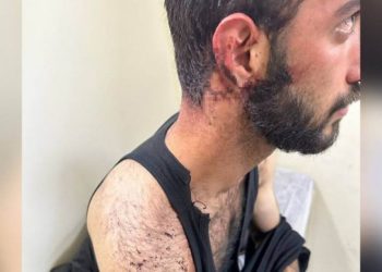 Polis şiddeti doktor raporuna 'baş ağrısı' olarak geçti
