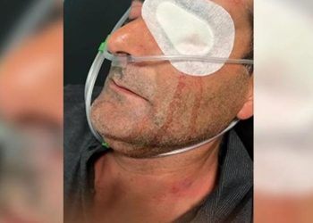 Seçim kutlamalarında etrafa ateş açan AKP ve Hüda-Par’lılar, kendilerini uyaran kişinin gözünü kör etti