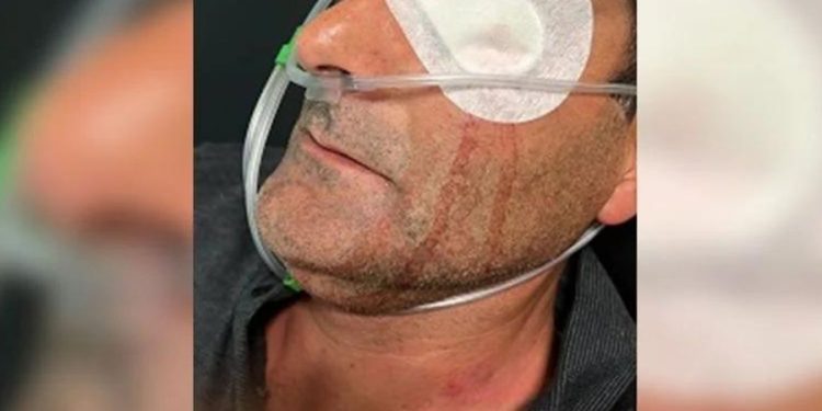 Seçim kutlamalarında etrafa ateş açan AKP ve Hüda-Par’lılar, kendilerini uyaran kişinin gözünü kör etti