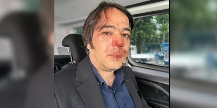 Üsküdar sahilindeki kaçak kafenin sahipleri, yıkıma gelen İBB ekiplerine saldırdı