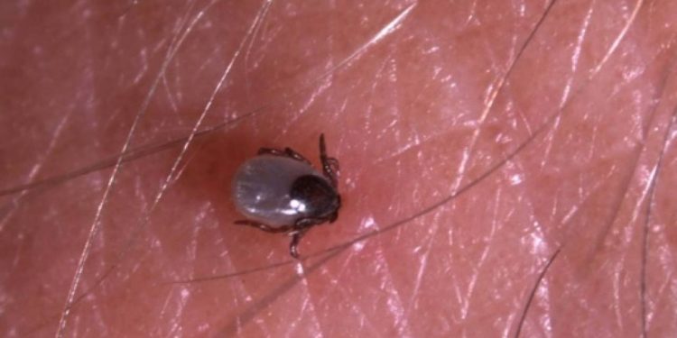 Vücuda yapışan keneyi çıkarmadan acil servise başvurun