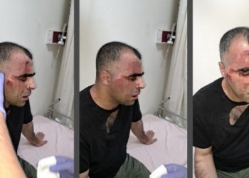 Gazeteci Aygül’e uygulanan şiddet Meclis’e taşındı