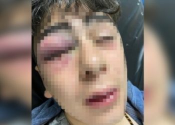 HDP: Yargı işkenceci polislere ‘arkanızdayız’ demiştir