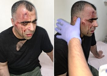 AKP’li Belediye Başkanı’nın korumaları gazeteciye saldırdı: ‘Bir daha başkan hakkında yazarsan geberirsin’