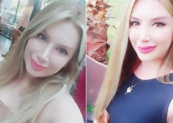 Botoks sonrası ölüm davasında ATK raporu: Dolgu maddesinin yanlışlıkla damar içine verilmesiyle öldü