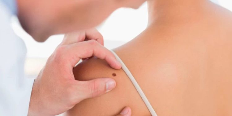 HPV kaynaklı cilt kanseri tedavisinde umut veren aşı