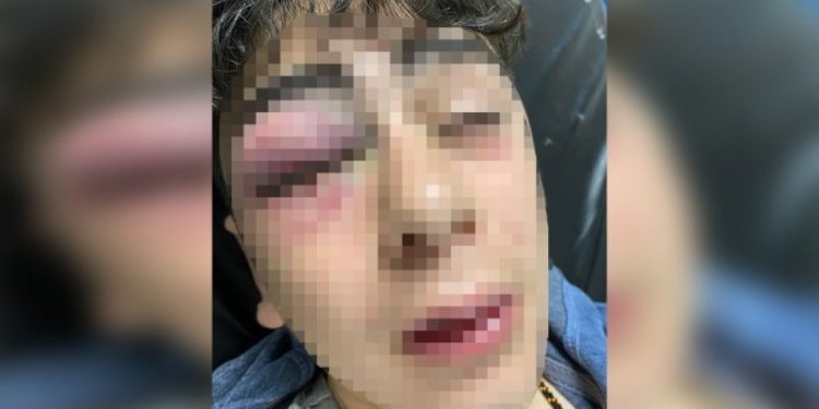 Lice'de 14 yaşında çocuğa işkence davasında tutuklanan üç polise tahliye