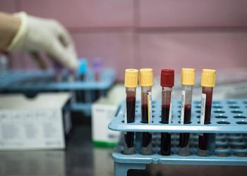 Oxford'dan kanserle mücadele için umut: Kan testiyle her üç kanserden ikisi tespit edildi