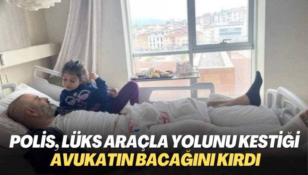 Polis, lüks araçla yolunu kestiği avukatın bacağını kırdı