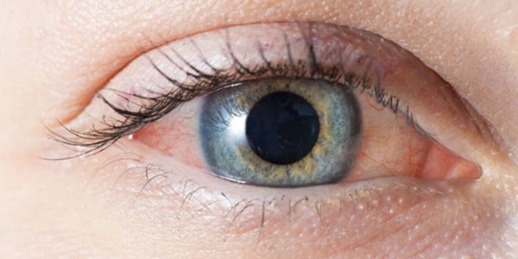 Prof. Dr. Demirci: Gözdeki kaşıntının altından demodeks çıkabilir