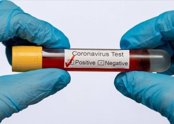 131 milyon avroluk Kovid-19 aşısı imha edilecek