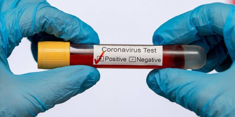 131 milyon avroluk Kovid-19 aşısı imha edilecek