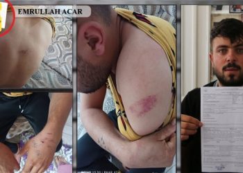 Başına çuval geçirilerek kaçırılan gence 11 saat işkence