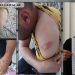 Başına çuval geçirilerek kaçırılan gence 11 saat işkence
