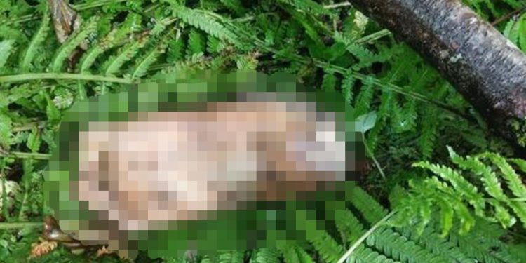 Artvin'de kopmuş ayak bulundu, belediye DNA için anons geçti