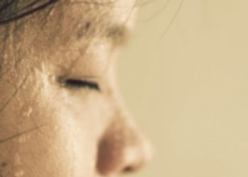 'Aşırı terleme enfeksiyonlara davetiye çıkarıyor'