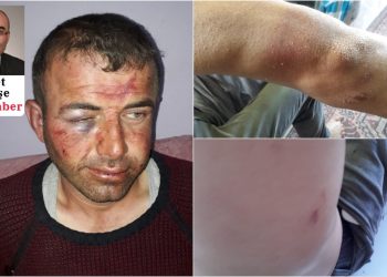 Jandarmanın darbettiği Osman Kale'ye 'Şikayetçi olma' baskısı