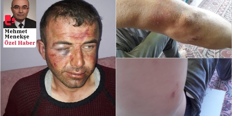 Jandarmanın darbettiği Osman Kale'ye 'Şikayetçi olma' baskısı