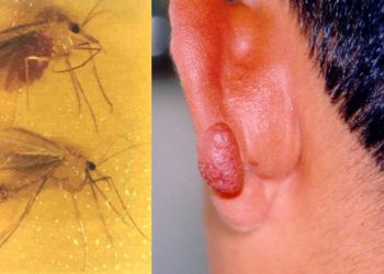 Kan emen kum sineği uyarısı: Sinekten beş kat küçük