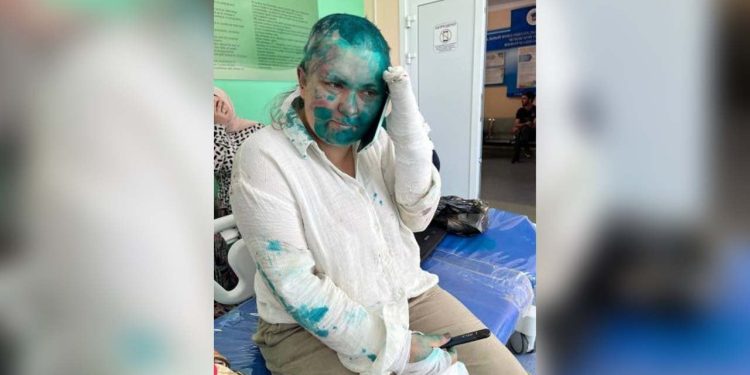 Muhalif Rus gazeteciye bıçaklı saldırı: Burayı terk edin ve hiçbir şey yazmayın