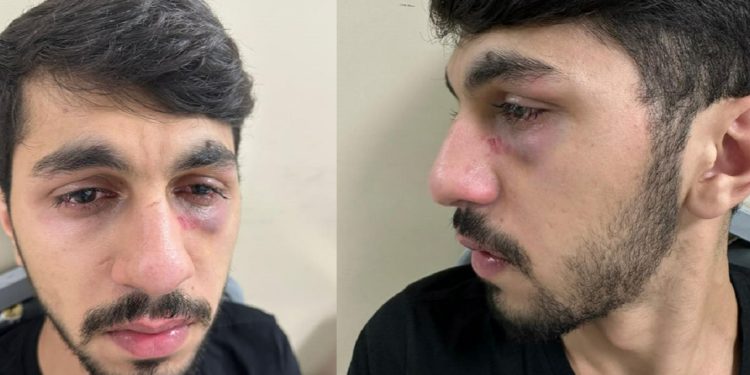 'Müzisyeni darp' ile suçlanan holding sahibinden tuhaf savunma: 'Bahşiş verdiğim birini dövmem'