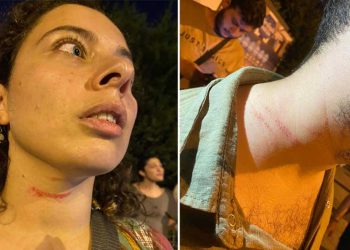 Suruç anmasında gözaltına alınanların avukatları da darbedildi