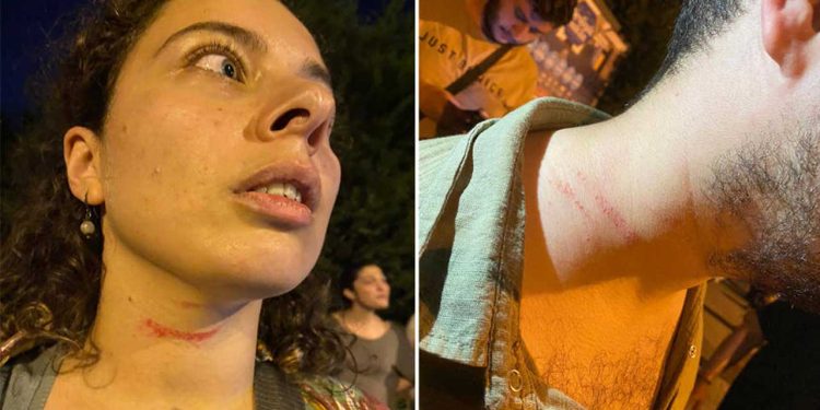 Suruç anmasında gözaltına alınanların avukatları da darbedildi