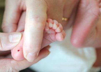 Topuk kanı testi nedir, topuk kanı hangi hastalıklar için alınır?