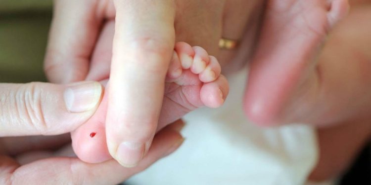 Topuk kanı testi nedir, topuk kanı hangi hastalıklar için alınır?