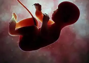 84 yaşındaki kadının karnından 40 yıllık cenin çıktı!