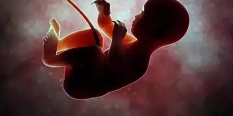 84 yaşındaki kadının karnından 40 yıllık cenin çıktı!