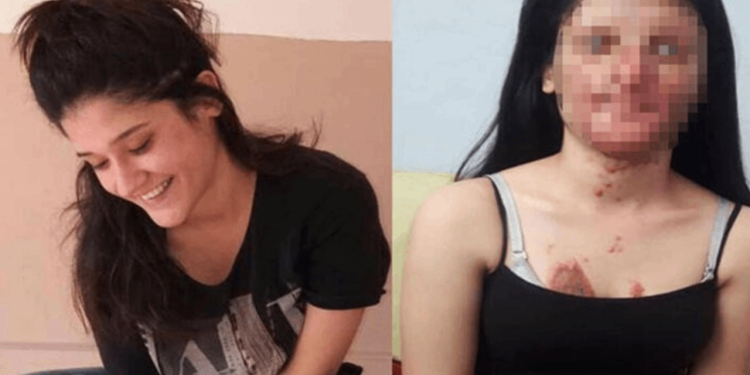 AKP ve MHP'nin infaz düzenlemesinin özeti: Bir kadının suratını asitle tanınmayacak hale getiren serbest, gazeteci tutuklanacak