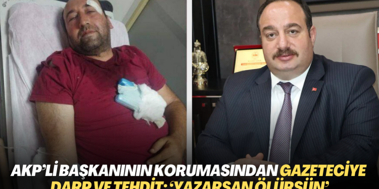 AKP’li başkanının korumasından gazeteciye darp ve tehdit: ‘Yazarsan ölürsün’