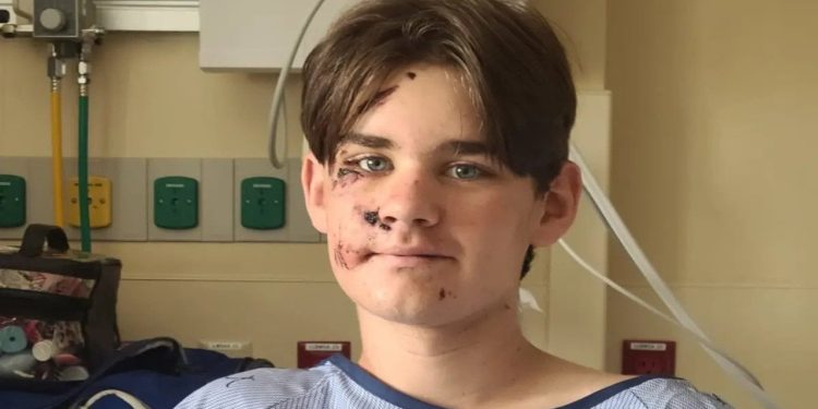 Büyük Kanyon'da yaklaşık 30 metre yükseklikten düşen çocuk hayatta kalmayı başardı