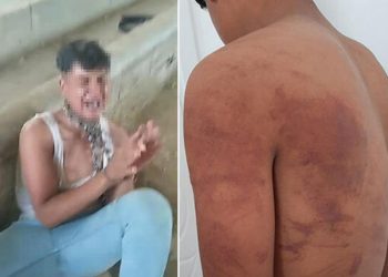 Şanlıurfa’da dayısını öldürmeyi reddeden 15 yaşındaki çocuğa ahırda işkence