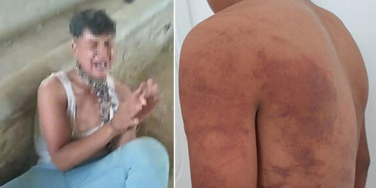 Şanlıurfa’da dayısını öldürmeyi reddeden 15 yaşındaki çocuğa ahırda işkence